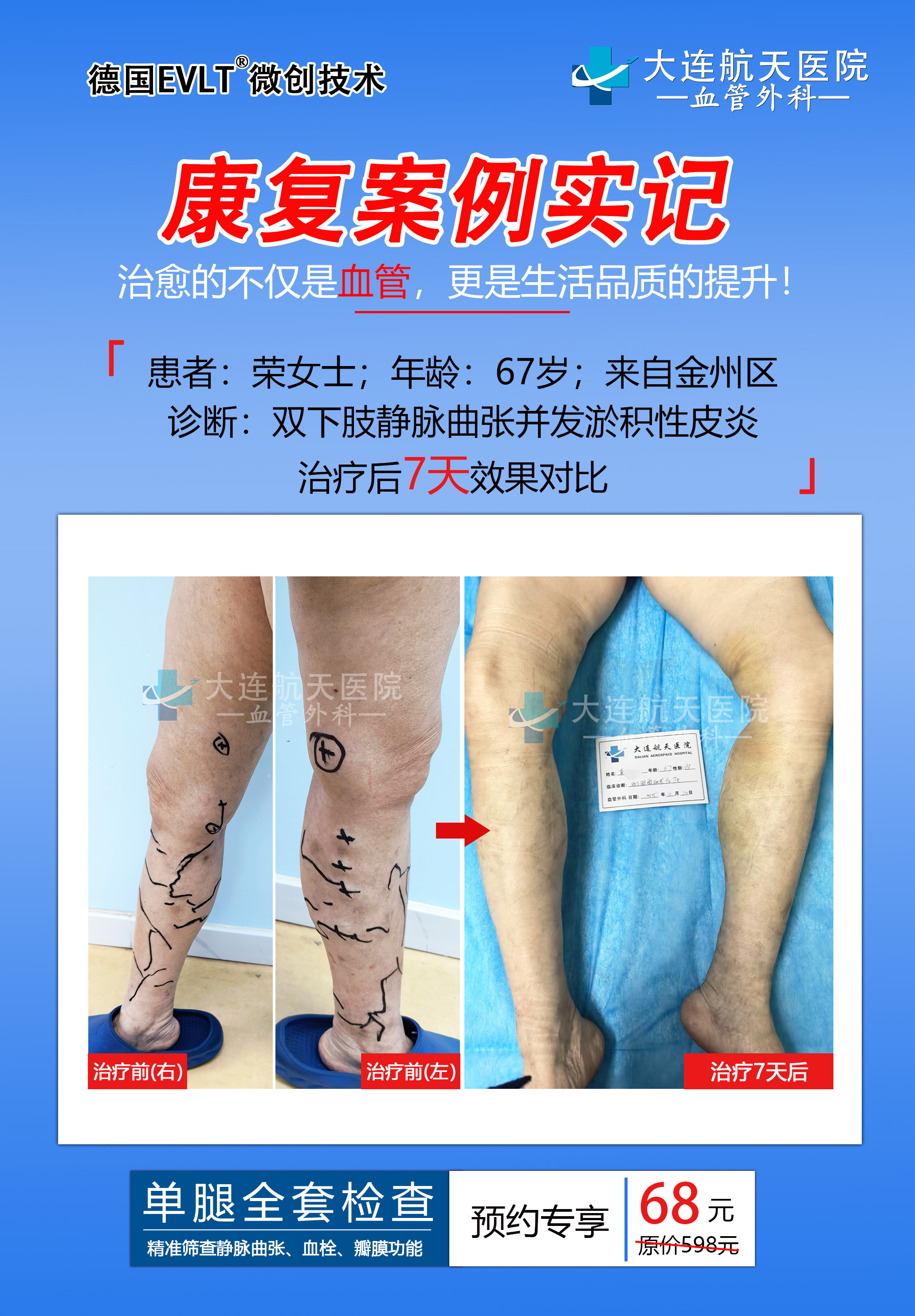 大连航天医院下肢血管病专科(图1) 大连航天医院下肢血管病专科(图1)